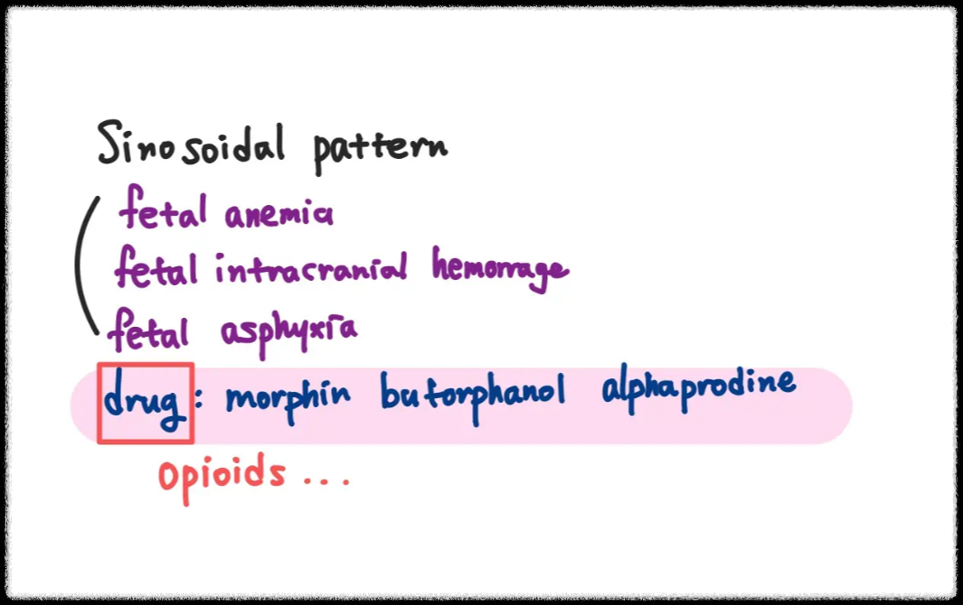 sinusoidal pattern