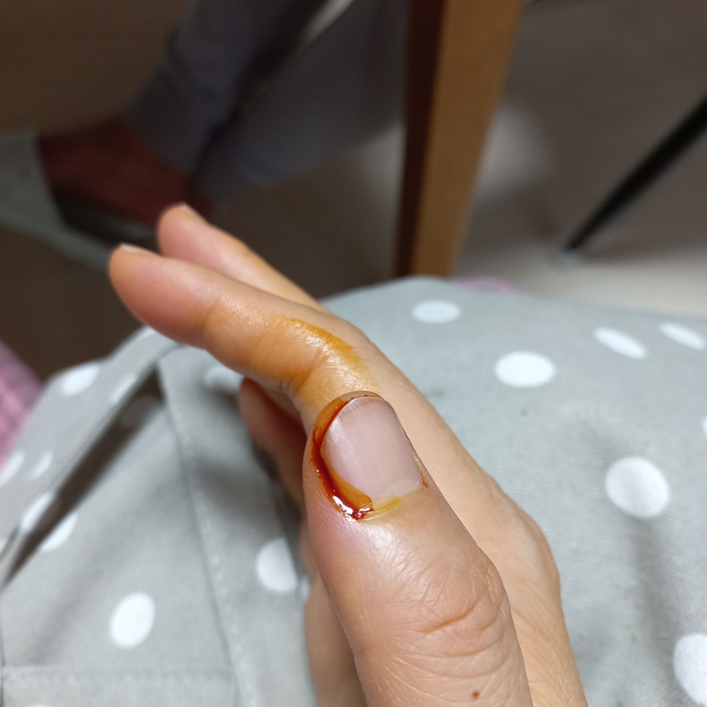  고양이 물림 보건소는 안되는듯, 내과에서 파상풍 항생제 처방 받아요