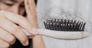 Understanding the Real Causes of Hair Loss and Effective Prevention and Treatment Methods.