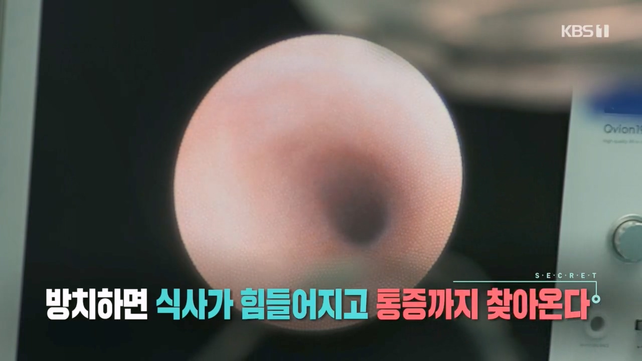 생로병사의 비밀.E894.240118p.H264-F1RST.mp4_20240118_193155.484.jpg