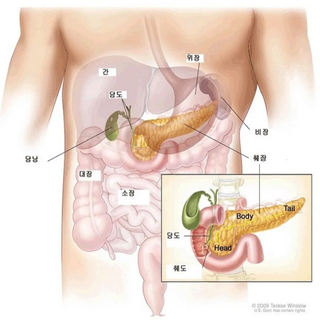 췌장암 초기증상 및 췌장암 원인