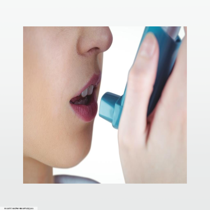 기관지확장증 치료