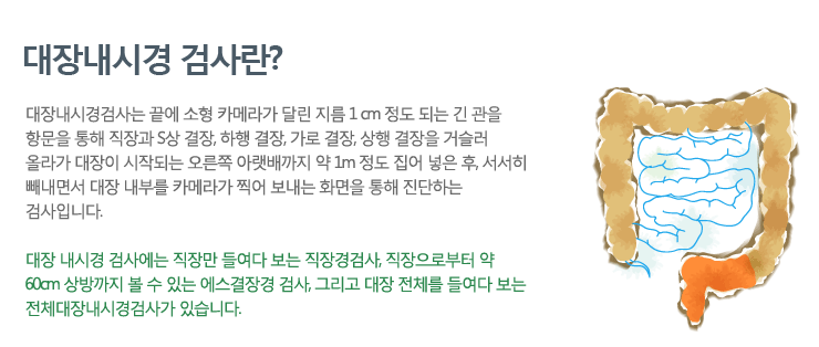 대장내시경 검사 설명