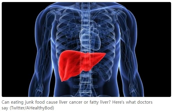 5년 안에 사망하는 간암...누가 왜 걸리나 ㅣ C형 간염 치료 후 암 추적 절차 크게 간소화 Researchers develop new stratification tool for liver cancer ri