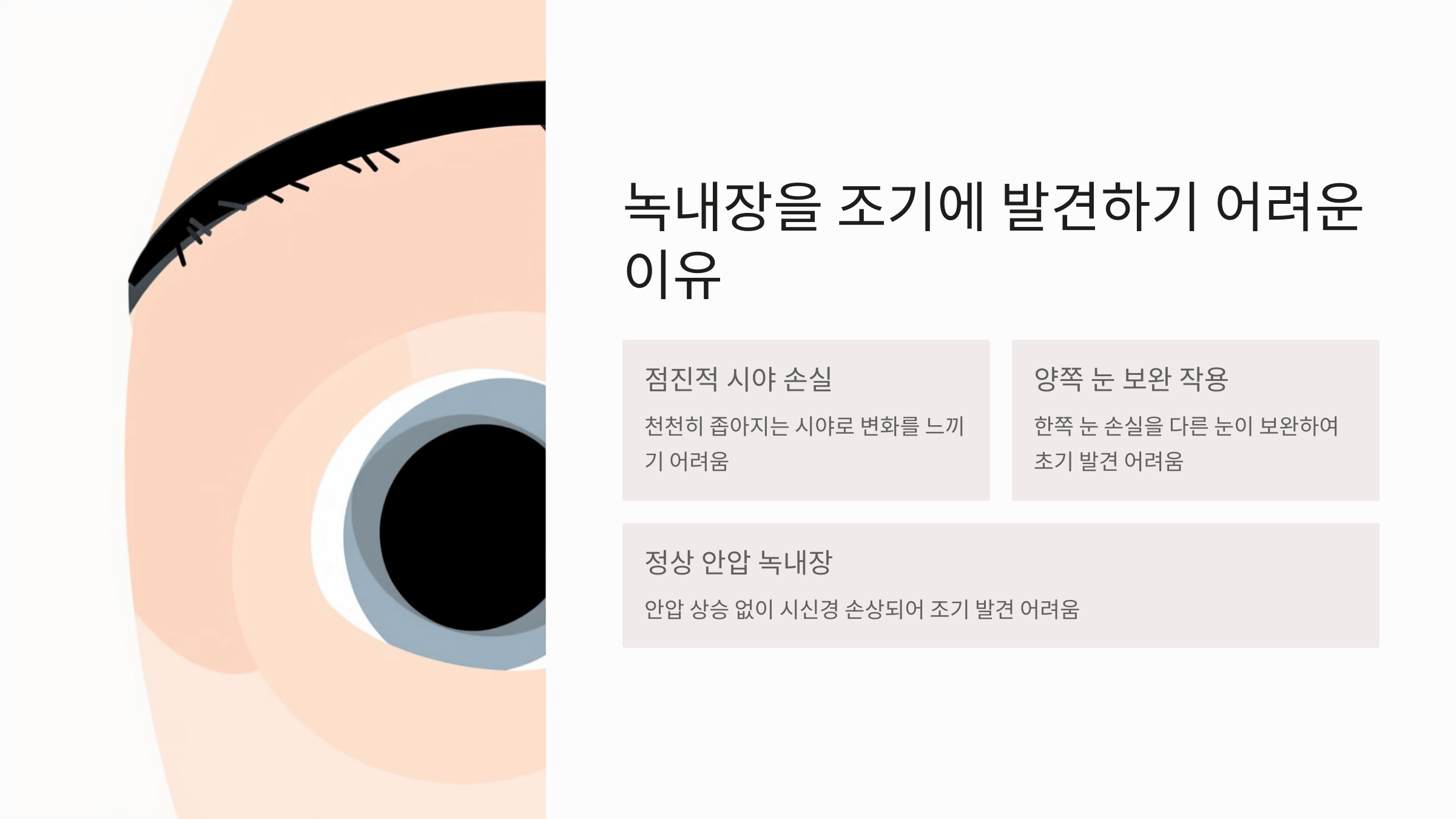 녹내장과 관련된 사진입니다.