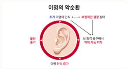 이명 증상 원인 치료방법