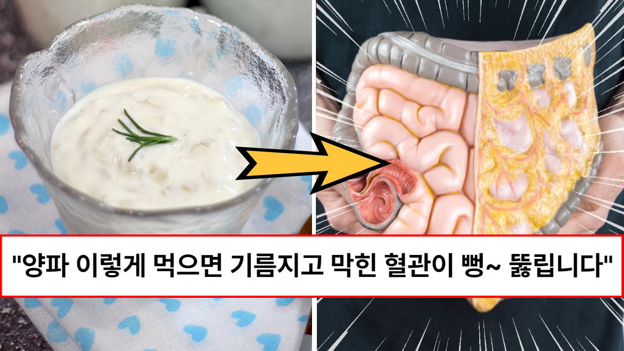 “다이어트에도 좋습니다” 막힌 혈관을 청소하고 피를 깨끗하게 만들어 주는 양파 요구르트 & 유산균 양파