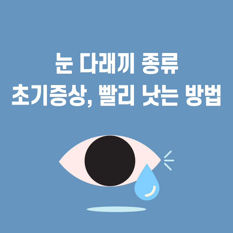  눈 다래끼(맥립종) 초기증상 원인 빨리낫는 법
