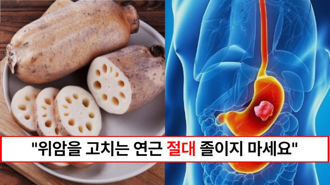 "연근 더이상 졸이지 마세요" 위염, 위궤양, 위암에 좋은 연근 영양소 손실 없이 먹는방법