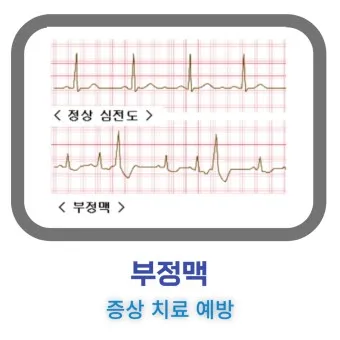 부정맥 증상 원인 치료방법_8