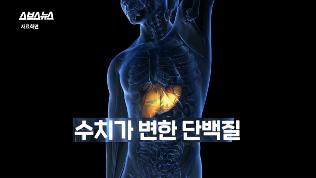 30대 후반 여성 급노화, 얼굴 주름살, 피부관리, 자기관리, 건강 뷰티 팁줌 매일꿀정보