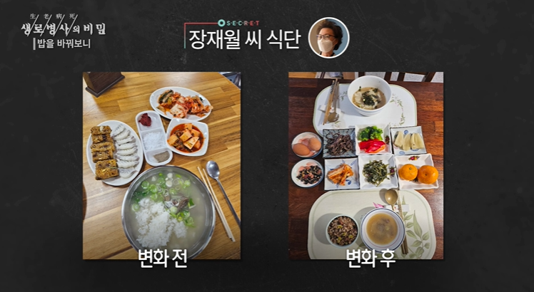 3주간 밥 바꿔보기 변화 관찰 - 장재월 씨