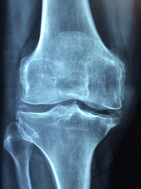 무릎연골-글루코사민