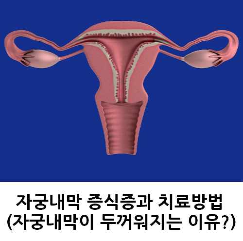 자궁내막 증식증과 치료방법 (자궁내막이 두꺼워지는 이유?)