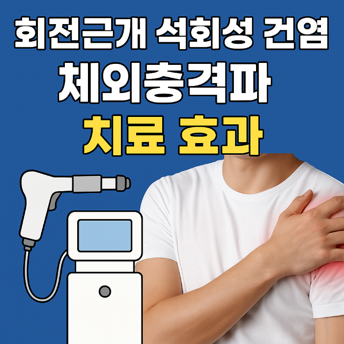어깨 통증의 주범, 회전근개 석회성 건염! 체외충격파로 치료 가능할까?