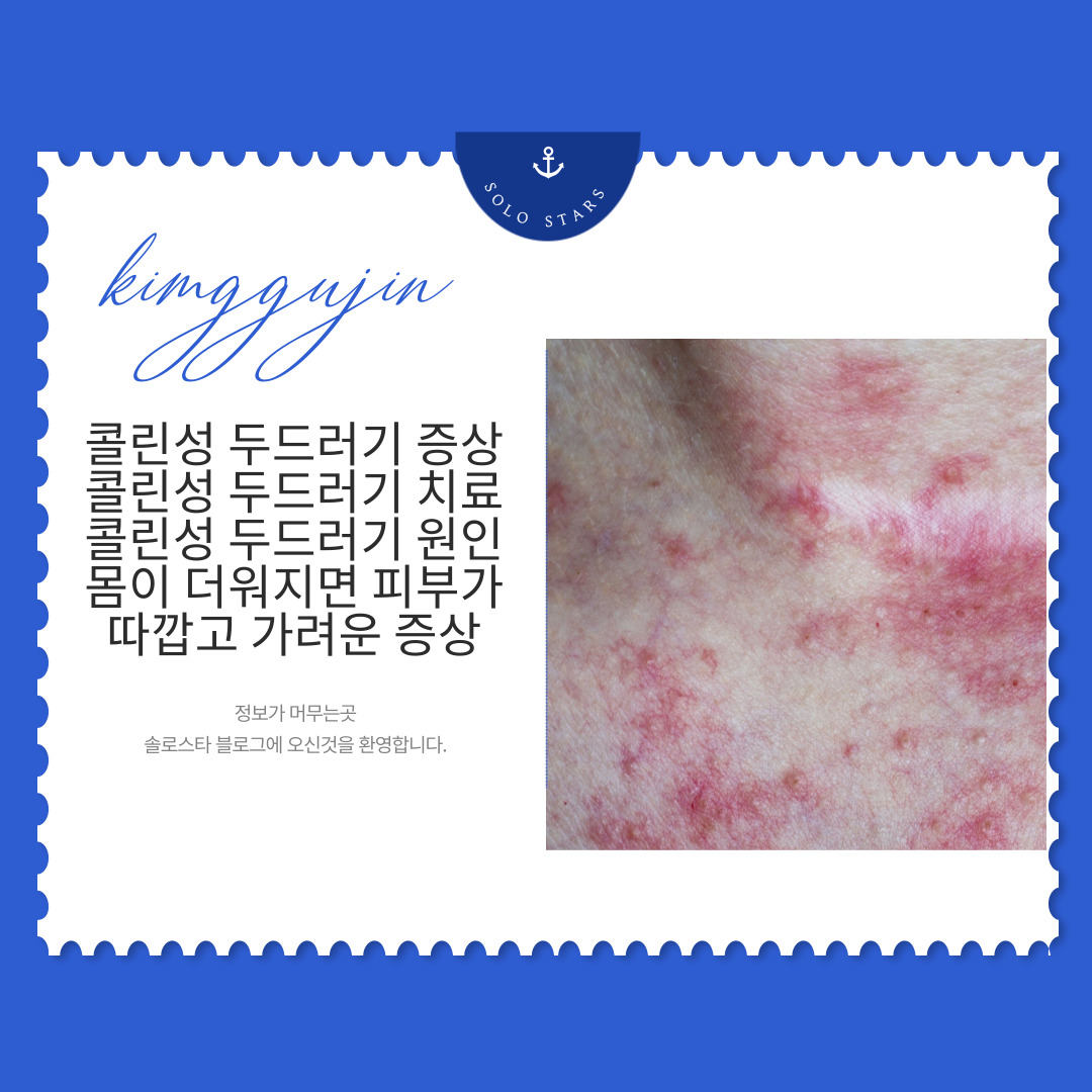 콜린성 두드러기 증상 사진