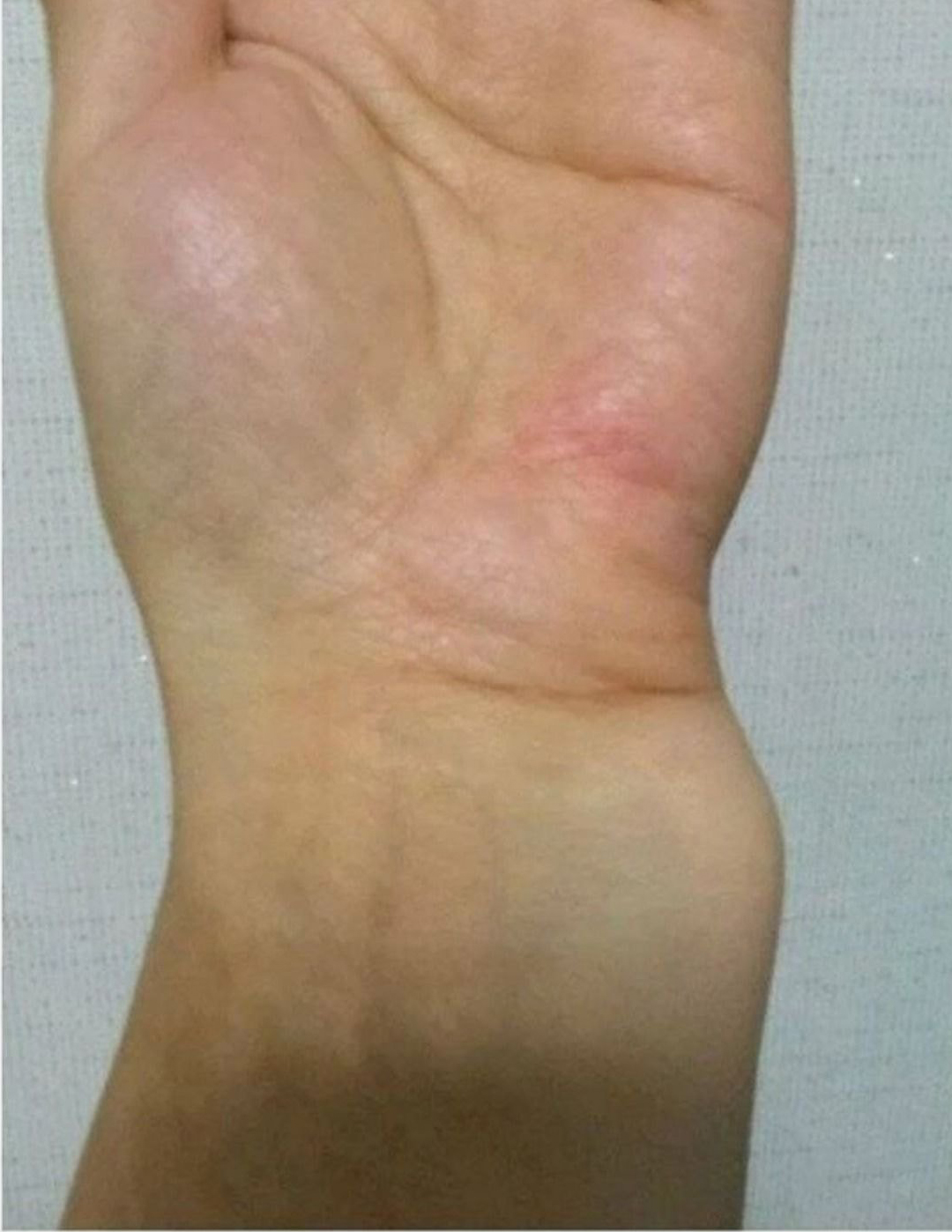  손목브레이커를 본 응급의학과 교수님
