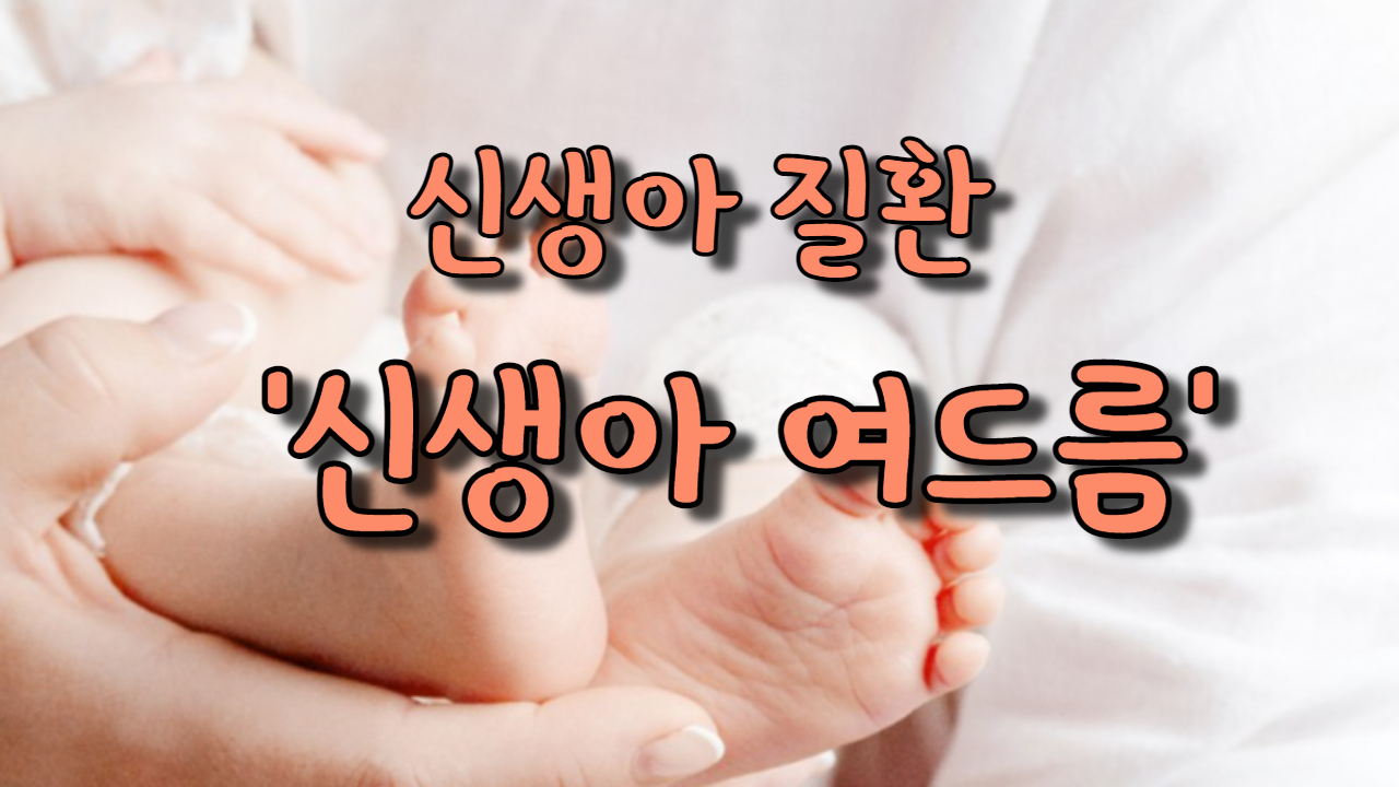  신생아 질환 '신생아 여드름'