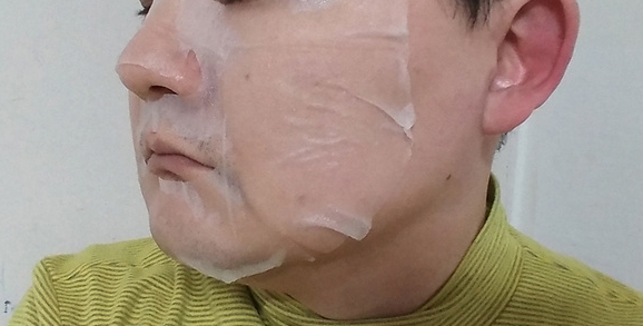  팔자주름 없애는 방법