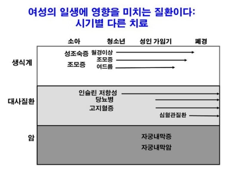 다낭성난소증후군의 증상