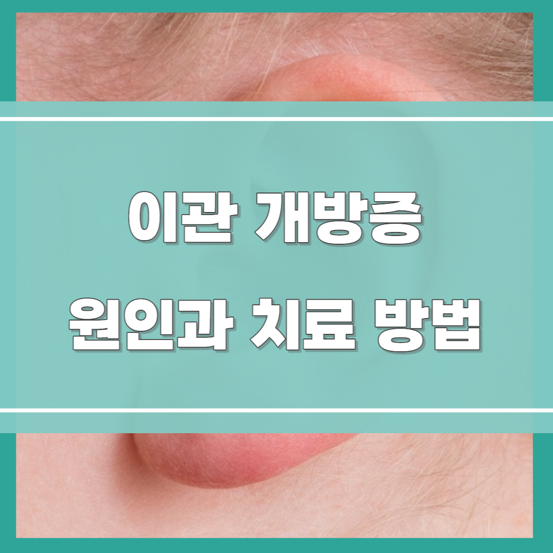  이관개방증 원인과 치료, 자연 치유 가능?