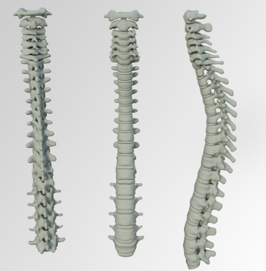 척추내시경수술은 최근 발전한 수술 기술로&#44; 작은 구멍을 통해 척추관을 확장시켜주는 치료 방법이다