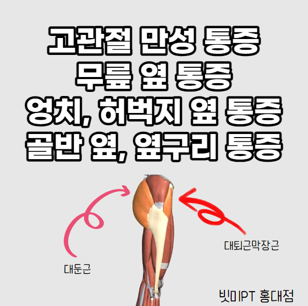  [홍대PT, 합정PT, 서교동PT] 고관절 만성 통증, 무릎 옆 통증(빗미PT)