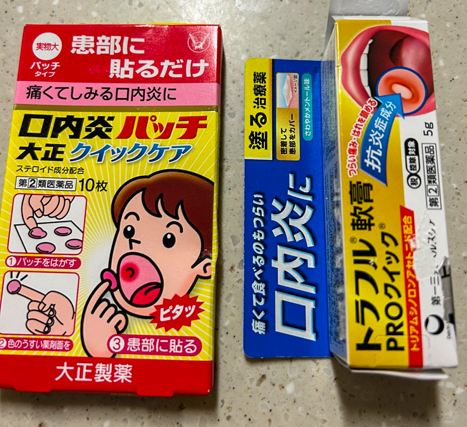 일본 구내염 약