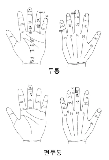 두통 수지침 편두통 혈자리_3