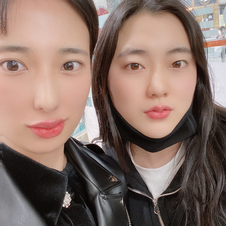 입술 보톡스 부작용 대전 입술필러+입꼬리보톡스 내돈내산 11