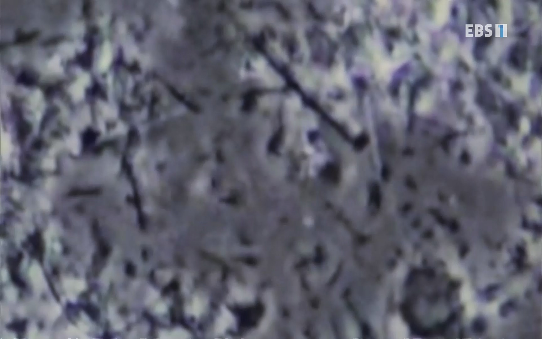 EBS 명의 헬스케어 - TV - 교육의 중심 EBS치주염이 코로나로 소홀해진 구강관리가 치아를 더 망가트리고 위험하게 만들며, 증상이 없기 때문에 특히 더 조심하고 치은염 단계에서 진행되지 않도록 예방해야한다 정의원 교수님과 치_20220505_151706.569.jpg