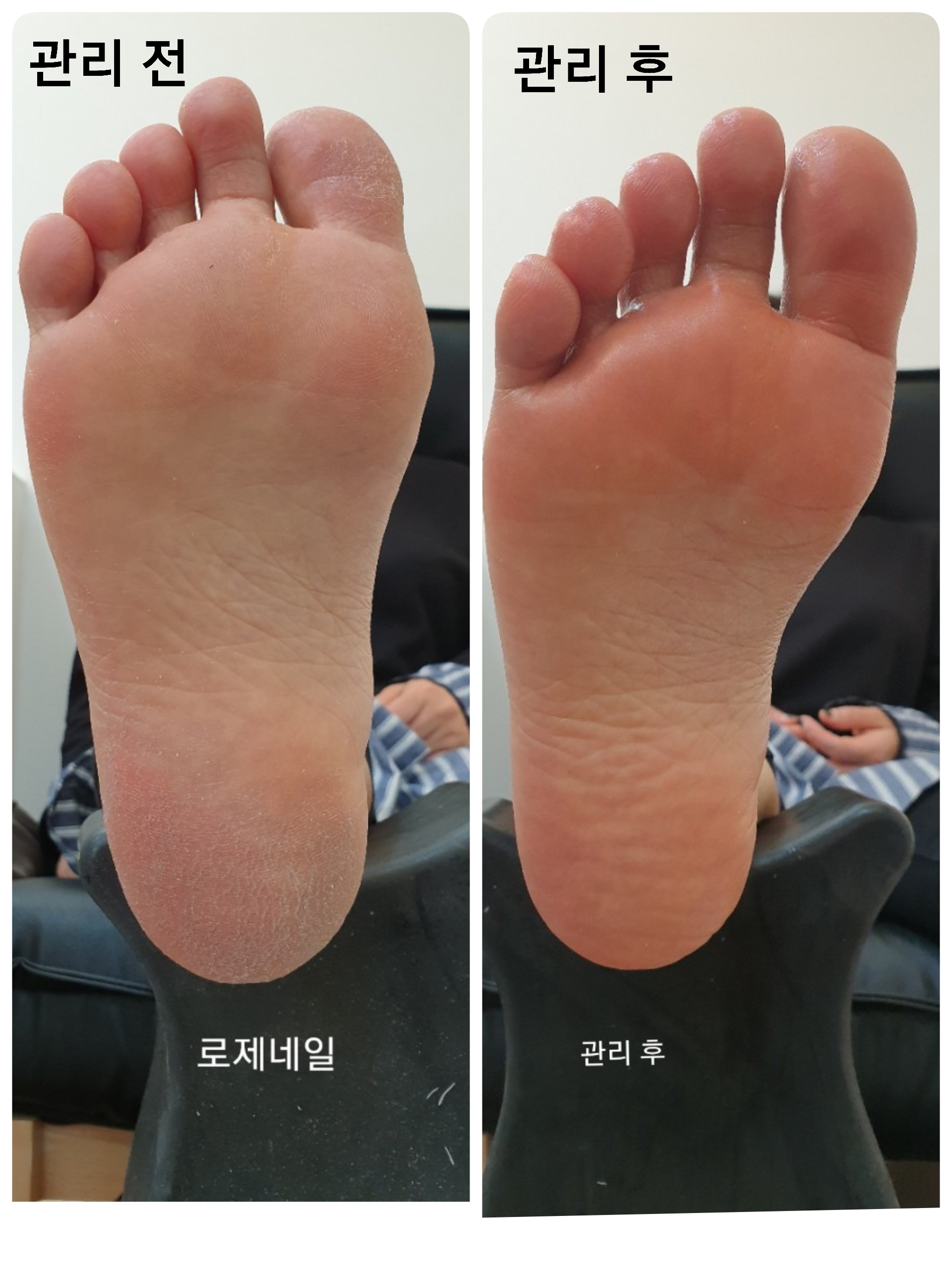 로제네일 이미지