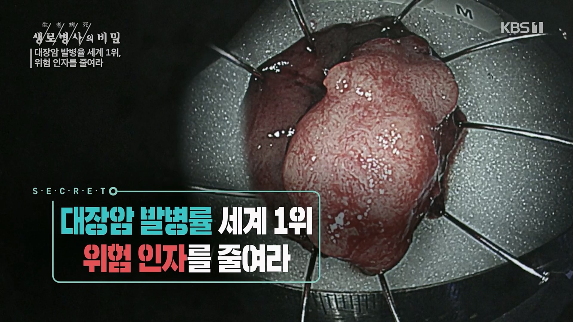 생로병사의 비밀.E858.230301p.H264-F1RST.mp4_20230302_192825.003.jpg