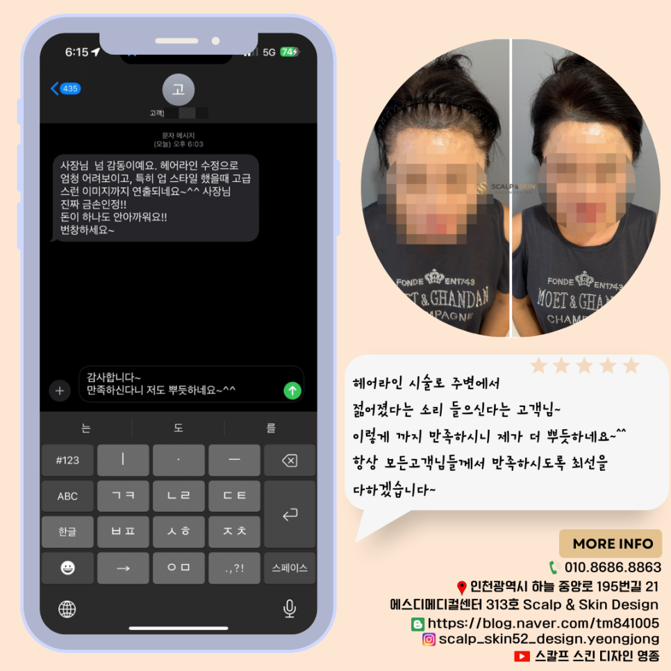 진헤어라인 이미지