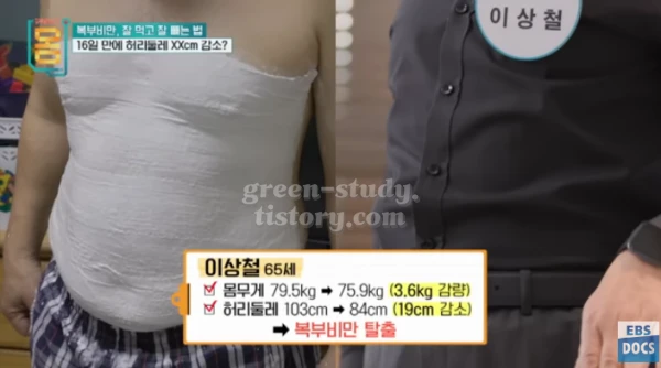 복부비만 운동 식단 방법_16.webp