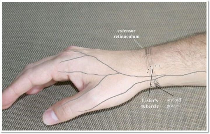 손목 신전근 지지대에 신경이 압박되면 저림 증상이 나타나는 부위 사진