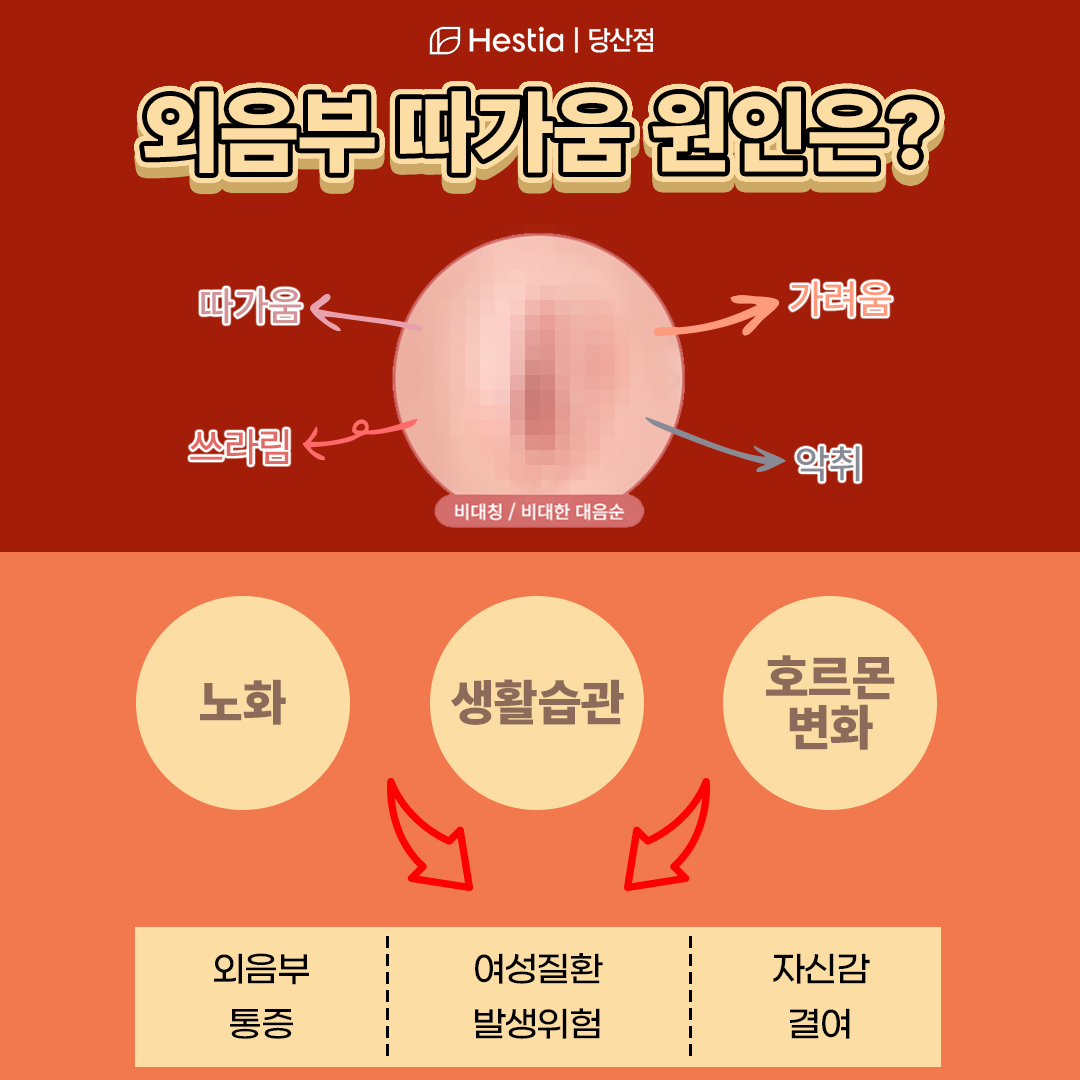 외음부따가움 원인은?