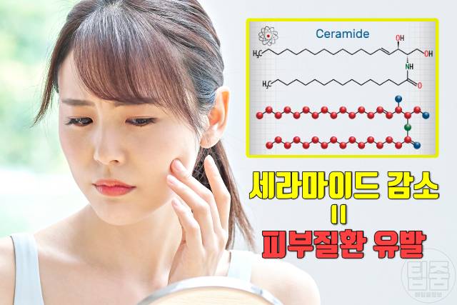 안면 건조 각질 세포 세라마이드 피부염증의 효능