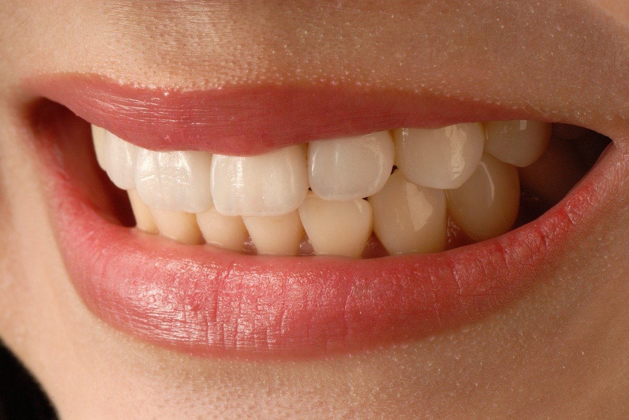 여성의 가지런한 치아 모습