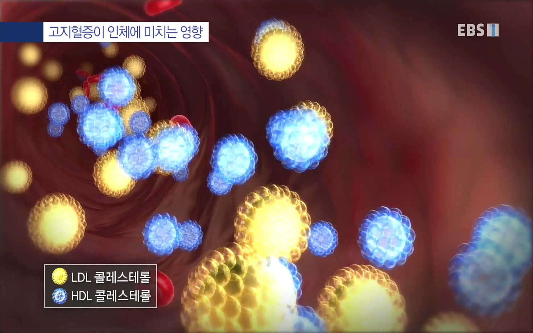 EBS 명의 헬스케어 - TV - 교육의 중심 EBS인생을 바꾸는 최고의 한 끼.mp4_20220925_180404.412.jpg
