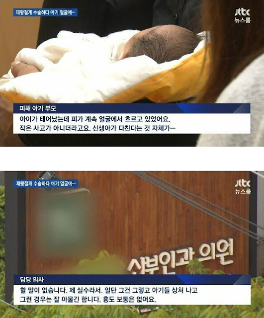  제.왕절개 수.술 도중에 신.생.아 얼.굴에 칼..질 해버린 의.사 ㄷㄷ