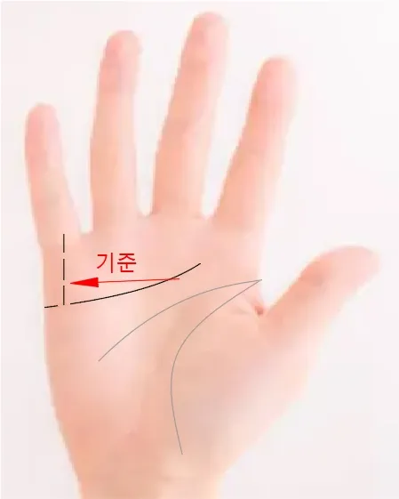 새끼 손가락 아래에서 끊어진 감정선