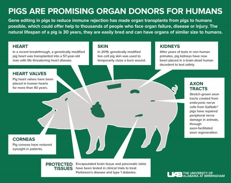 인간에게  사상 최초 돼지 신장 이종 이식 성공  VIDEO Pig-to-human kidney transplant 3D animation