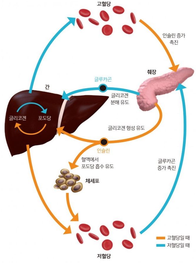 고혈당일때-저혈당일때-비교사진