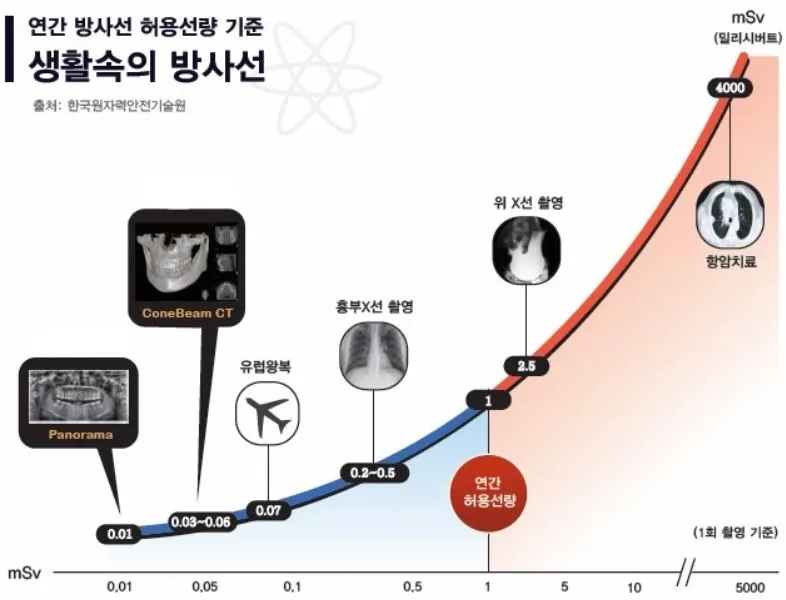 엑스레이 별 방사선 노출량