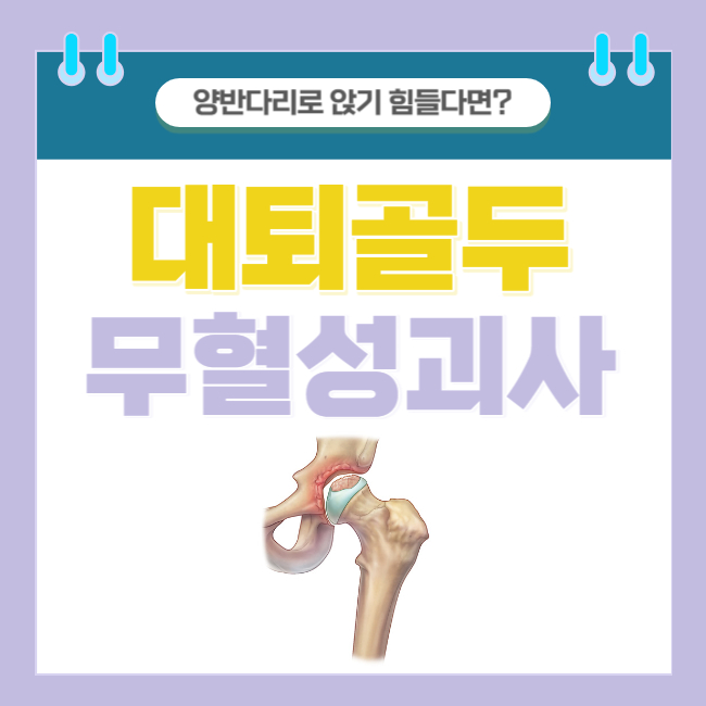  양반다리로 앉기 힘들다면? 대퇴골두 무혈성 괴사의 원인/증상/진단/치료