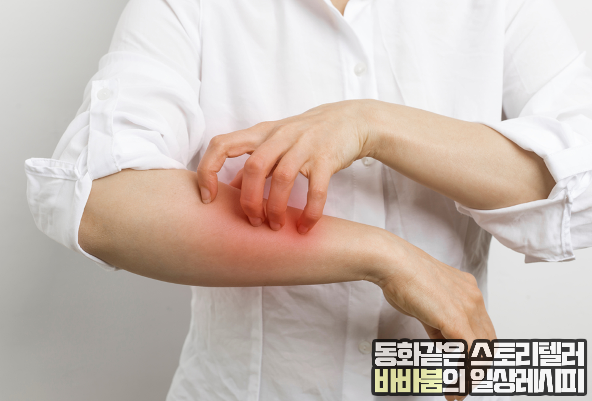  간질간질 가려운 '옴', 증상 및 치료의 모든 것!