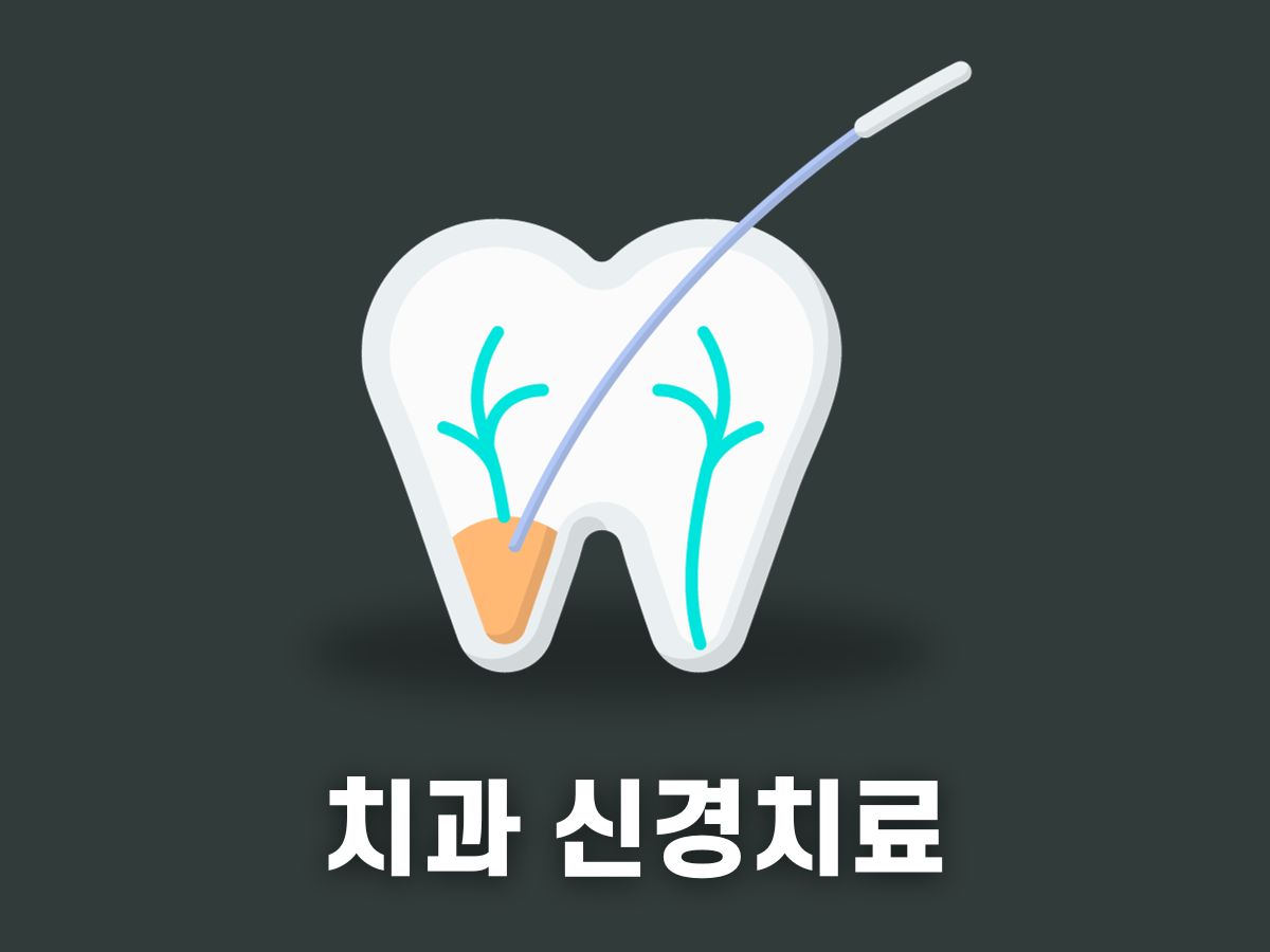 치과 신경치료