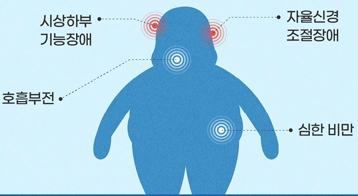 로하드증후군 증상 사진