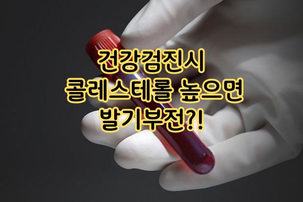 건강검진 콜레스테롤 높으면